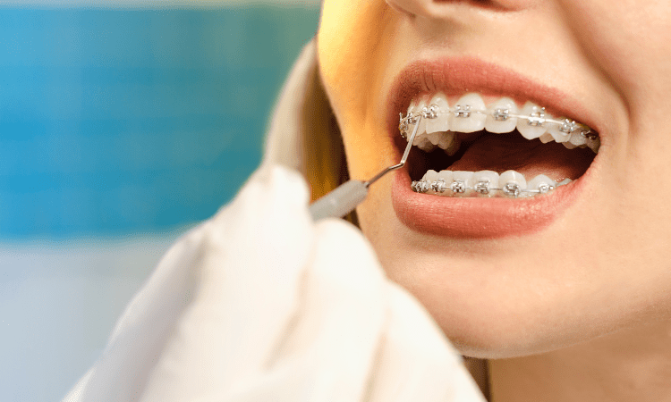 Proper care prevents cavities and gum disease. Neglecting oral hygiene can lead to prolonged treatment times.